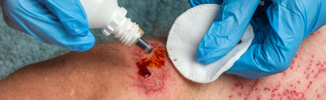 First Aid Cut Injury